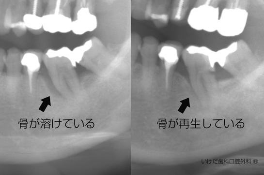 レントゲン.jpg