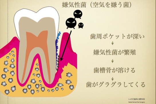 嫌気性菌.007.jpg